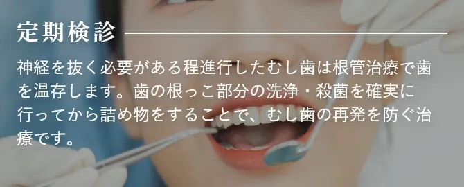 定期検診 神経を抜く必要がある程進行したむし歯は根管治療で歯を温存します。歯の根っこ部分の洗浄・殺菌を確実に行ってから詰め物をすることで、むし歯の再発を防ぐ治療です。